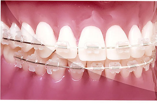 Reverse Curve G4 NiTi Tooth-Coloured  .016x.022 Upper