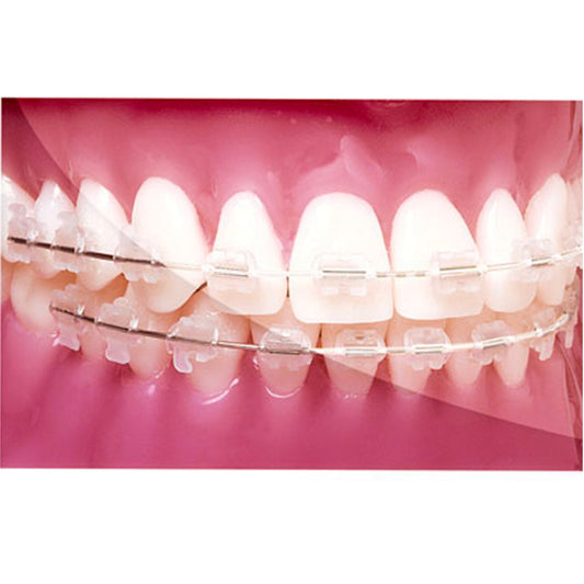 NiTi 014 Upper Reverse Curve Tooth-Coloured
